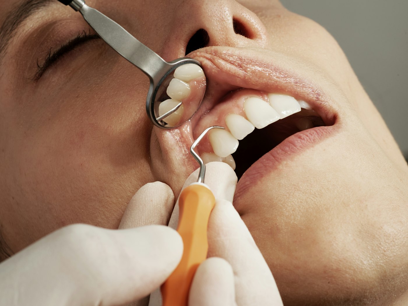 Dentist treating a smiling patient at Pearline, the best dental clinic in Dhaka