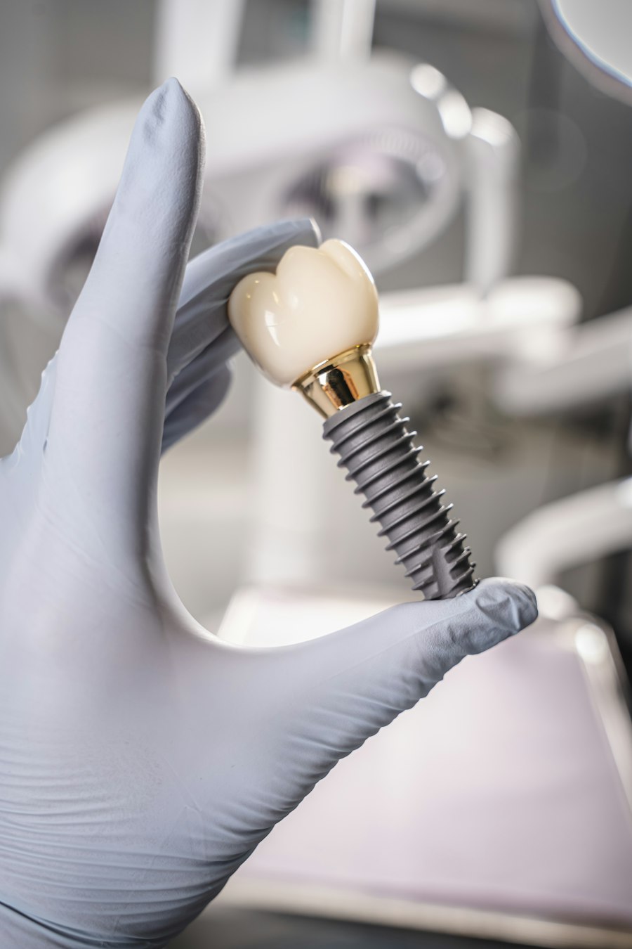 Dental implant and crown at the best dental clinic in Dhaka
