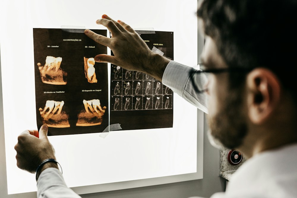 3D CBCT dental imaging in Dhaka
