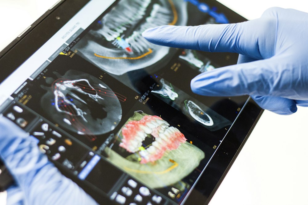 Dentist reviewing a 3D dental scan on a tablet