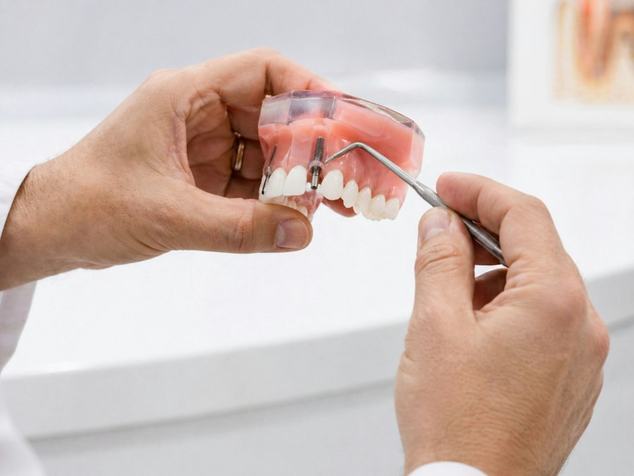 Intraoral 3D scanner used for digital dentistry